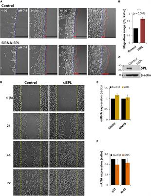 Modulated Start-Up Mode of Cancer Cell Migration Through Spinophilin-Tubular Networks